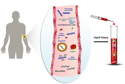 Surface Plasmon Resonance for Biomarker Detection: Advances in Non-invasive Cancer Diagnosis